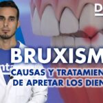 com saber si tengo bruxismo