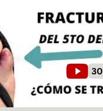 como saber si el dedo del pie esta fracturado