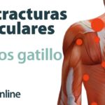 como saber si es contractura muscular