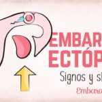 como saber si es embarazo ectopico