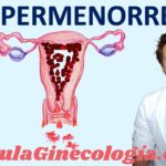 como saber si es hemorragia menstrual