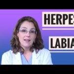 como saber si es herpes labial