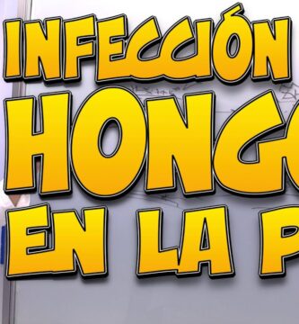 como saber si es hongo o alergia en la piel