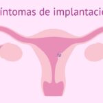 como saber si es implantación