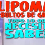 como saber si es lipoma