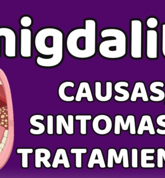 como saber si las anginas son bacterianas o viricas