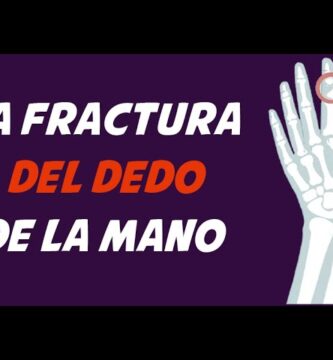 como saber si me fracture el dedo de la mano