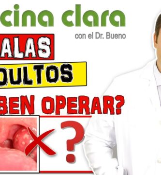 como saber si me tengo que operar las amigdalas