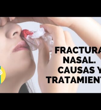 cómo saber si nariz rota