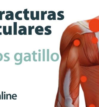 como saber si tengo contractura