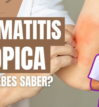 cómo saber si tengo dermatitis