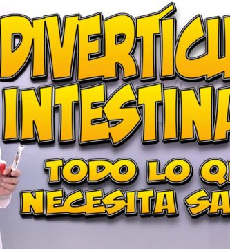 cómo saber si tengo divertículos