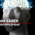 cómo saber si tengo epilepsia