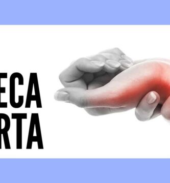 como saber si tengo esguince de muñeca