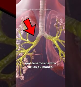 cómo saber si tengo flemas