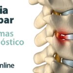 cómo saber si tengo hernia discal