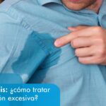 cómo saber si tengo hiperhidrosis