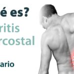 como saber si tengo neuritis intercostal