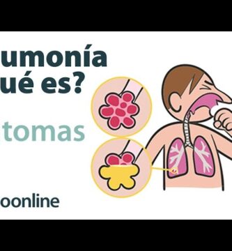 como saber si tengo pulmonía