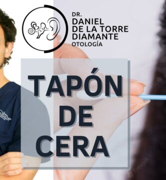 como saber si tengo tapon de cerumen