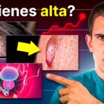 cómo saber si tengo testosterona alta