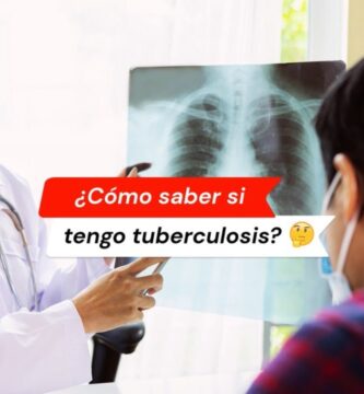cómo saber si tengo tuberculosis