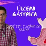 como saber si tengo ulcera gastrica