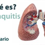 como saber si tiene bronquitis