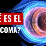 como saber si tiene glaucoma