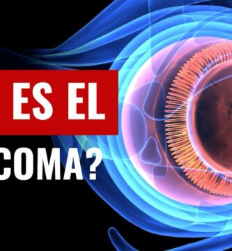 como saber si tiene glaucoma