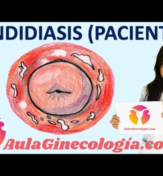 como saber si tienes infeccion en tu parte intima