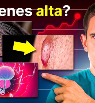 como saber si tienes testosterona alta