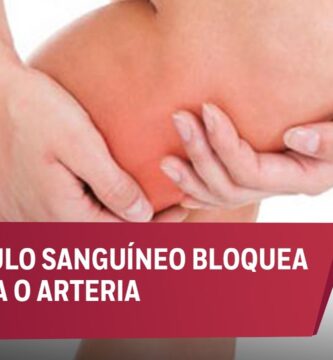 como saber si tienes trombo en pierna