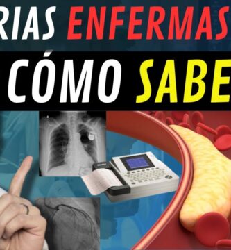 como saber si tienes una arteria obstruida