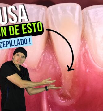 como saber si un diente se va a caer