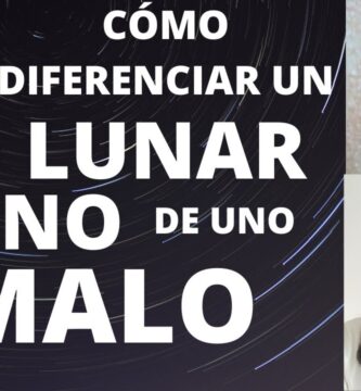 como saber si un lunar es bueno o malo