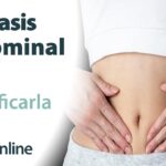 diástasis abdominal como saber si tengo